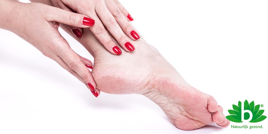 Alles wat je moet weten over hielkloven: Oorzaken, Preventie en Behandeling Alles wat je moet weten over hielkloven: Oorzaken, Preventie en Behandeling